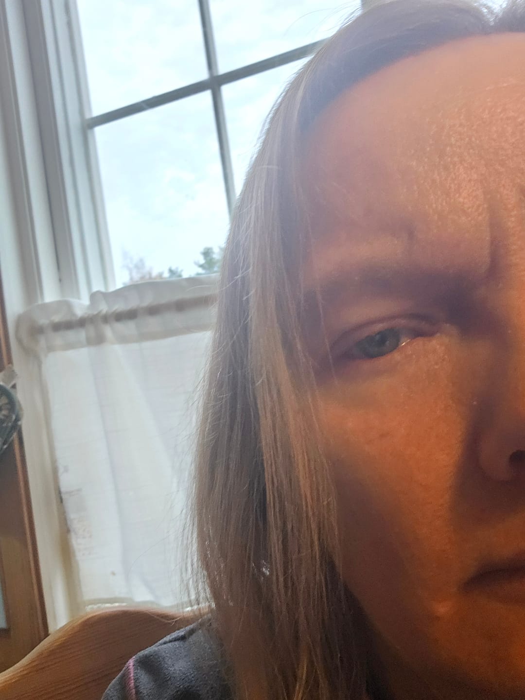 Reseña fotográfica de un cliente sobre el bálsamo para ojos