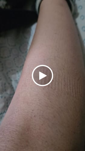 Customer video review of Depilador Nano Pro