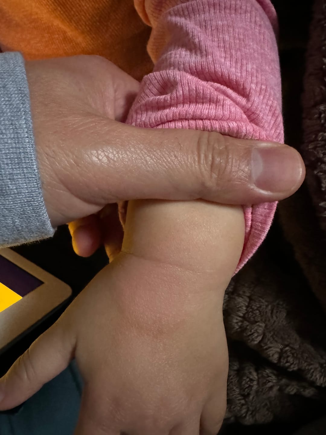 Customer photo review of Bioskin Junior Duo Pack (Free Outbreak Rescue Cream)