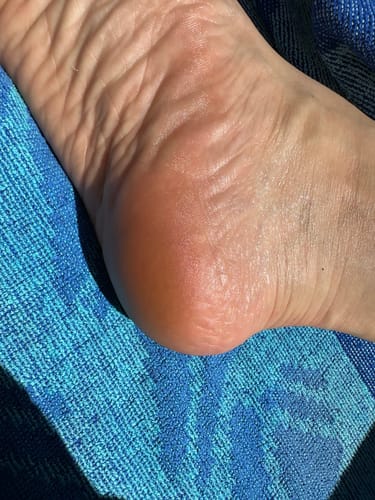 Customer photo review of Seyskyn Cantaloupe Orange Glass Foot File