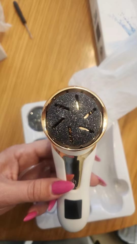 Customer photo review of SoleCare Elektrisk Fjerner til Hård Hud