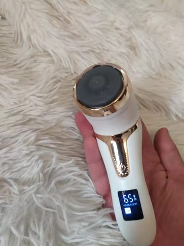 Customer photo review of SoleCare Elektrisk Fjerner til Hård Hud