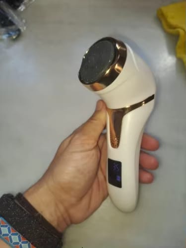 Customer photo review of SoleCare Elektrisk Fjerner til Hård Hud