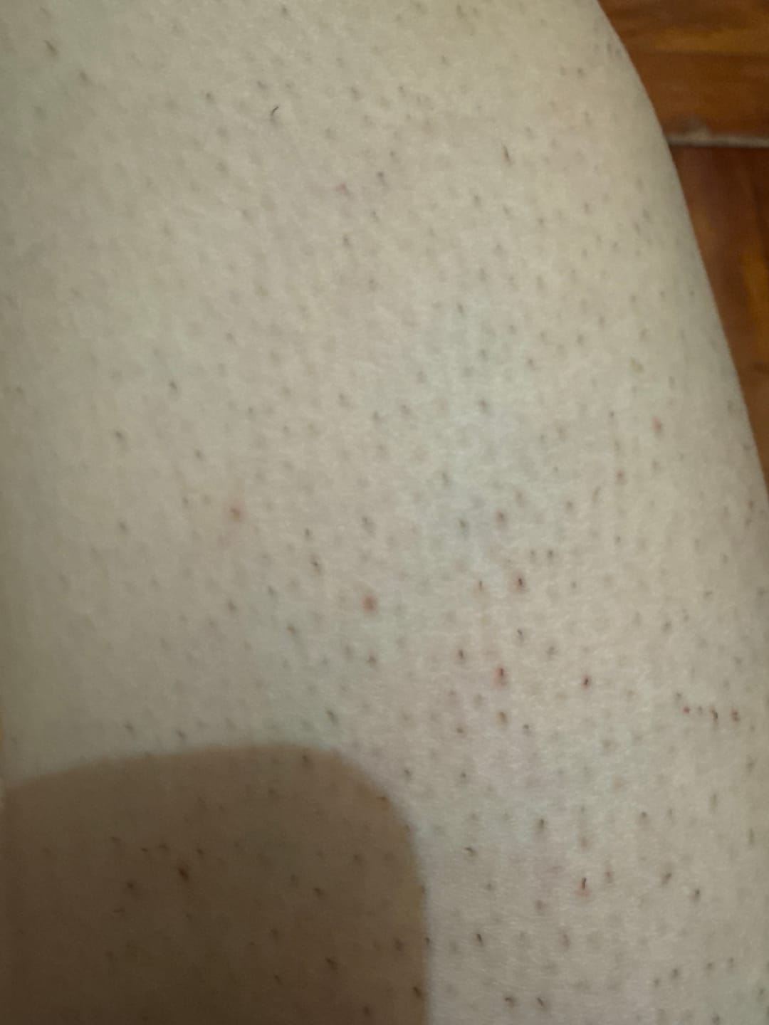 Customer photo review of Ulike Air10 家用脫毛儀