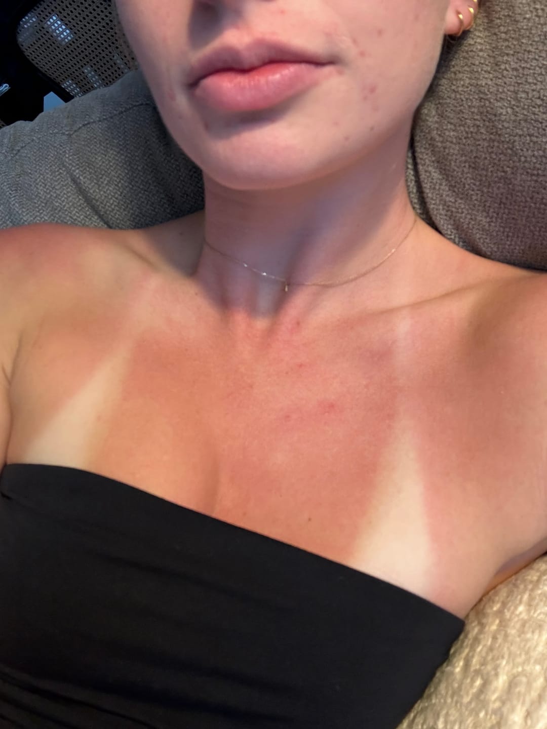 Customer photo review of Tan Accelerating Trio - Peptide Sun Tanning Lotion