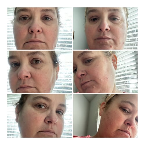 Customer photo review of Night Game Retinol Capsules