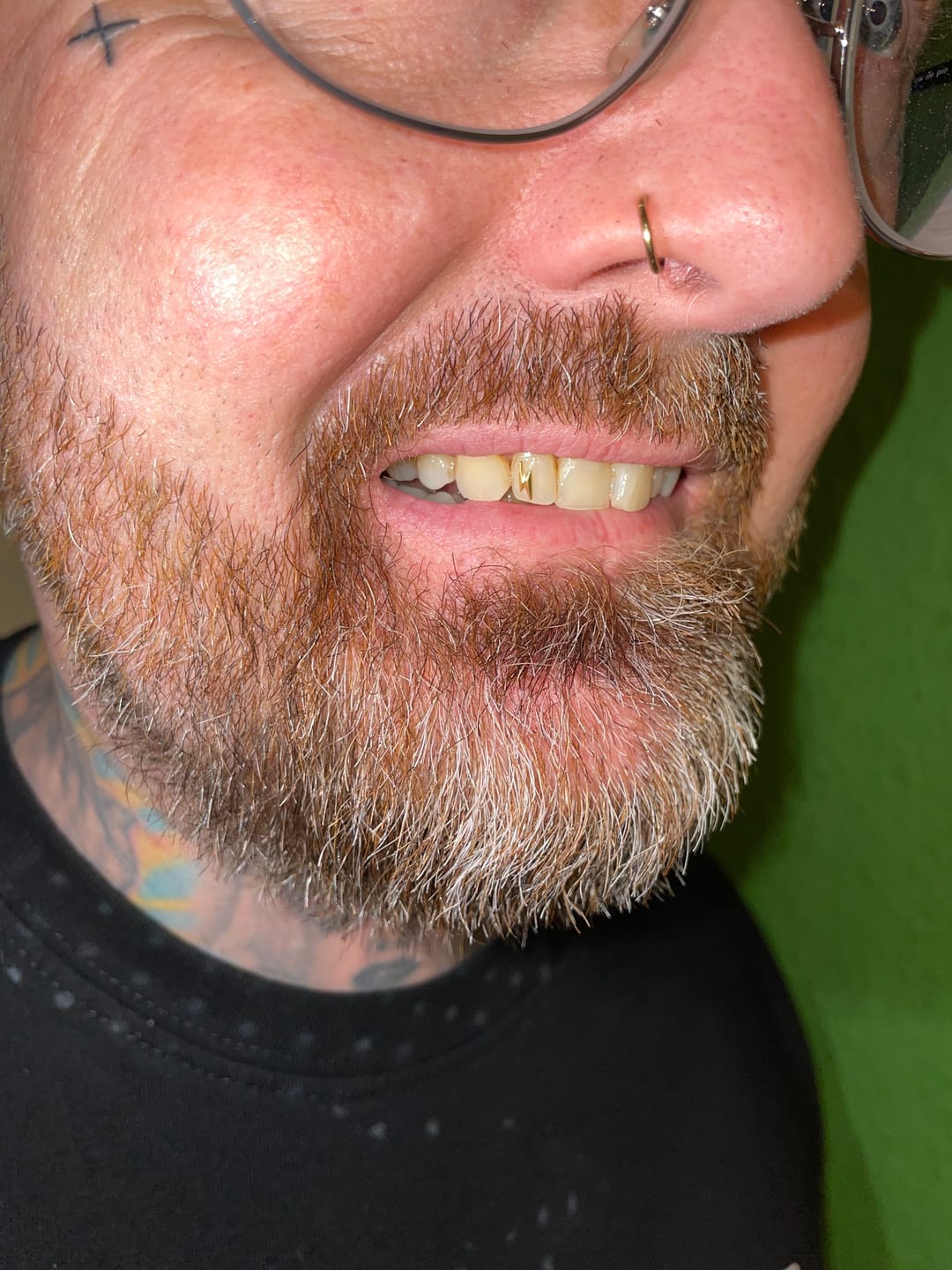 Customer photo review of Bolt 22-karat gold