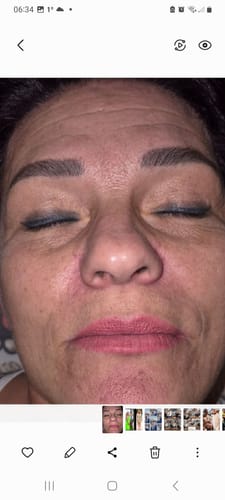 Customer photo review of Natural Botulin Serum