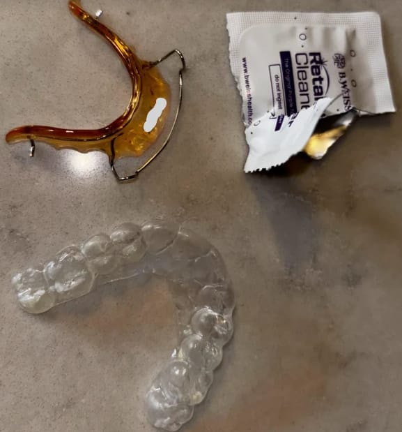 Customer photo review of Daily Retainer & Aligner Cleaner Tablets grape scented