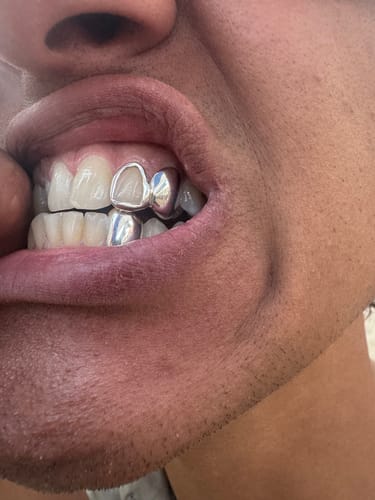 Customer photo review of LUMINA (SILVER GRILLZ)