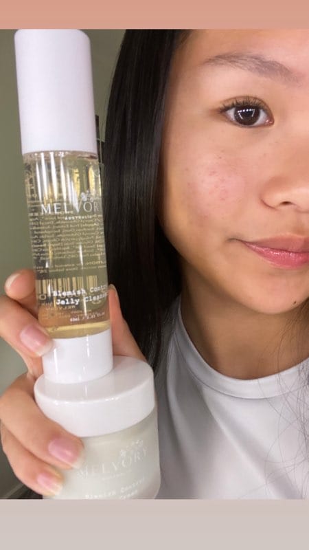 Customer photo review of Blemish Control Jelly Cleanser