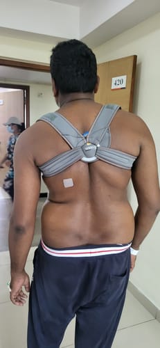 Customer photo review of Meek Clavicle Brace | Supports the Clavicle & Promotes Healing (Grey)