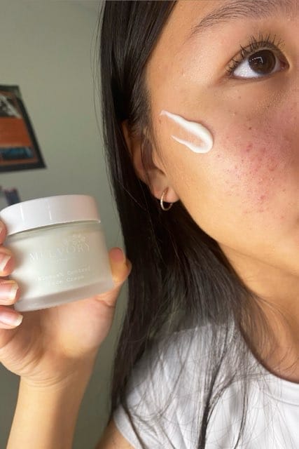 Customer photo review of Blemish Control Face Cream