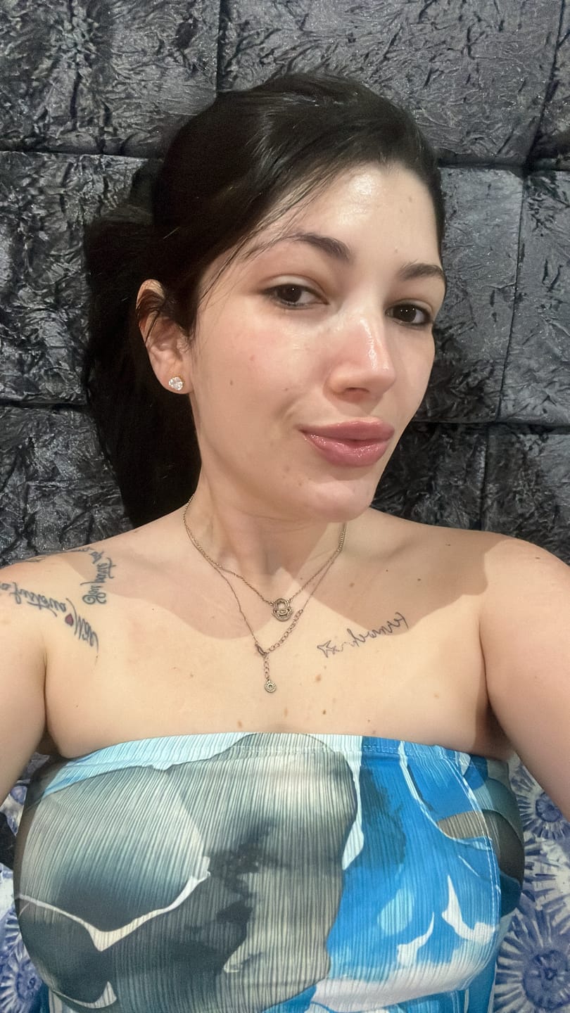 Customer photo review of Niacinamida + Vitamina C