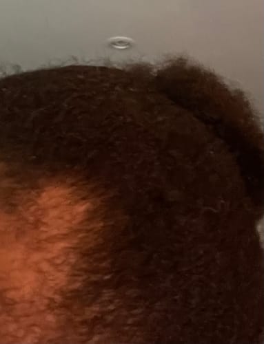 Customer photo review of Mama First - Gummies post-partum