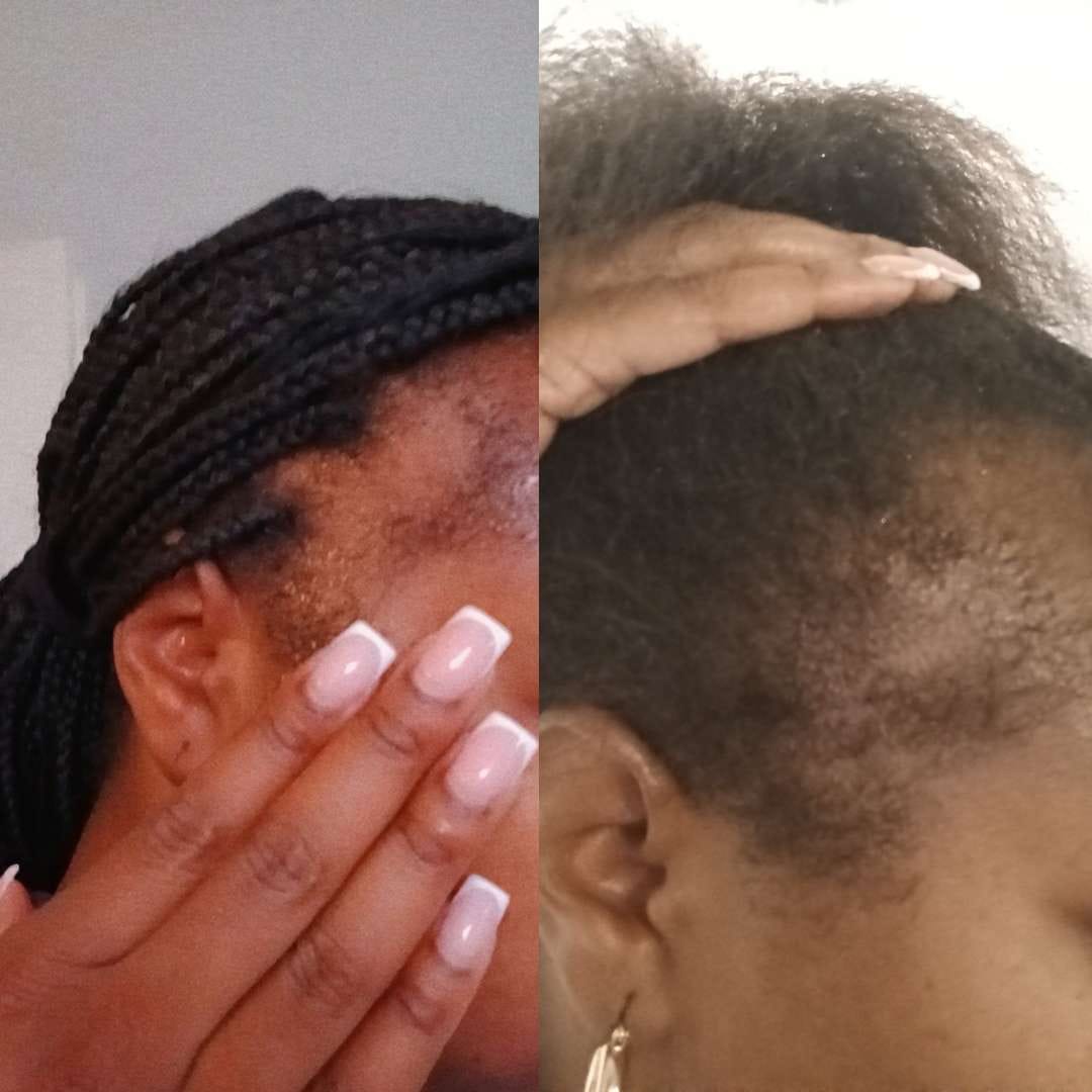 Customer photo review of Herbal Growth Oil