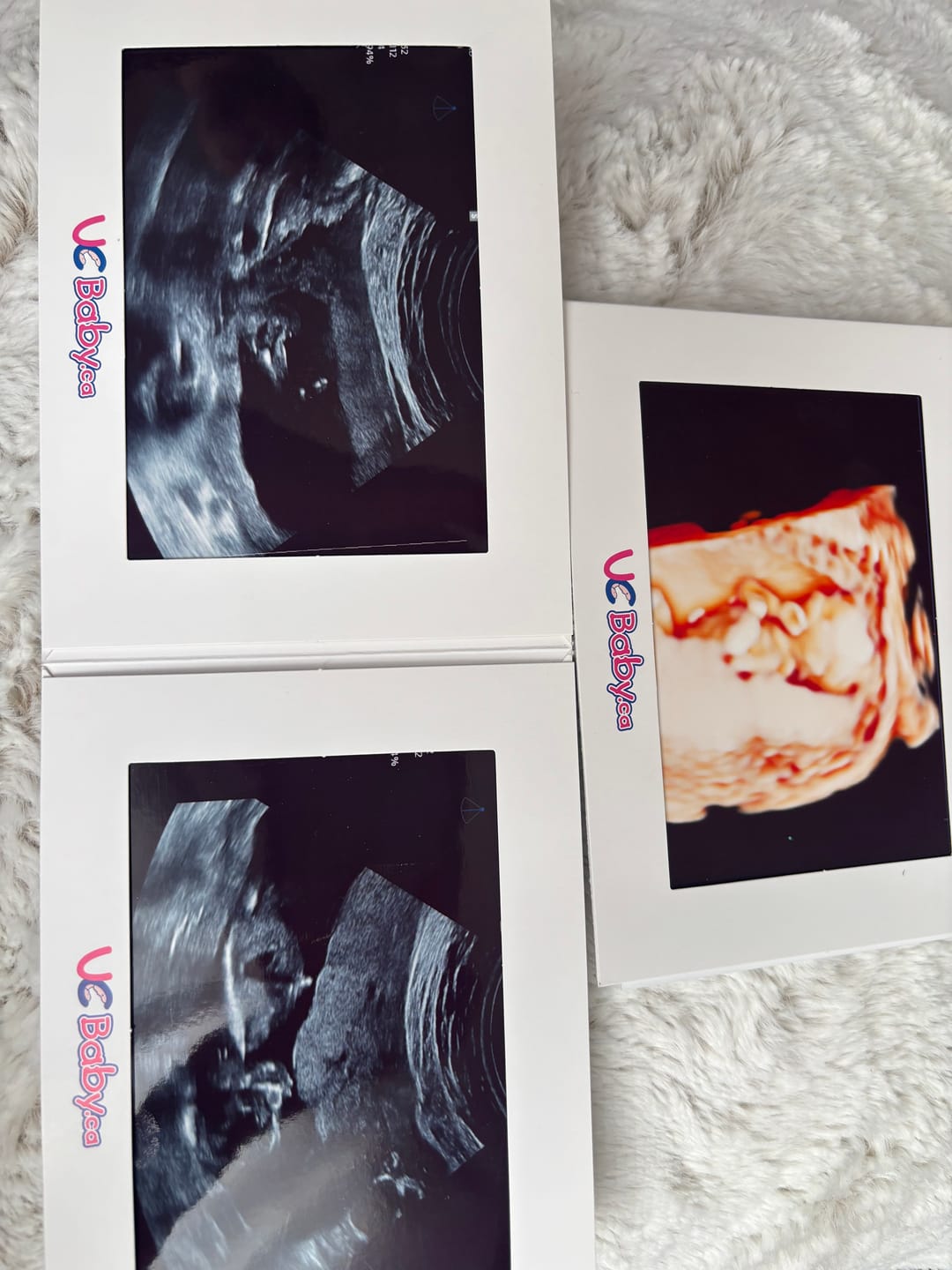 Customer photo review of EarlyReveal Tap DNA Gender Test Over 99% Accurate | Painless & Needle Free | Next Day Results