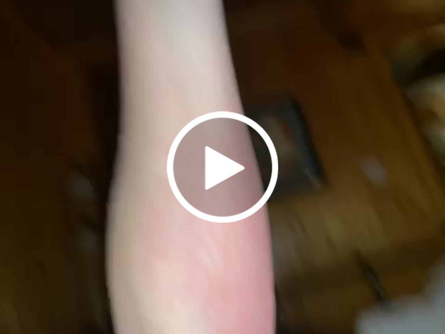 Customer video review of Natural Grade Bee Venom Therapy Kit