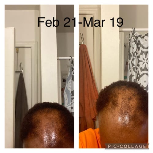 Customer photo review of Movatte Ultra Drops