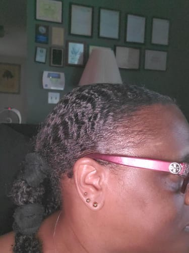 Customer photo review of Movatte Ultra Drops