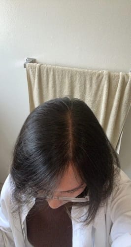 Customer photo review of Movatte Ultra Drops