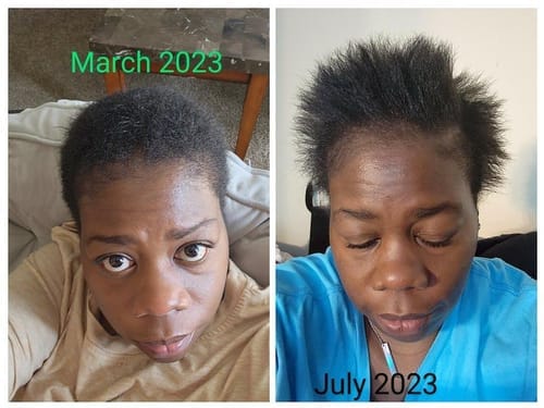 Customer photo review of Movatte 3-Phase Growth System™