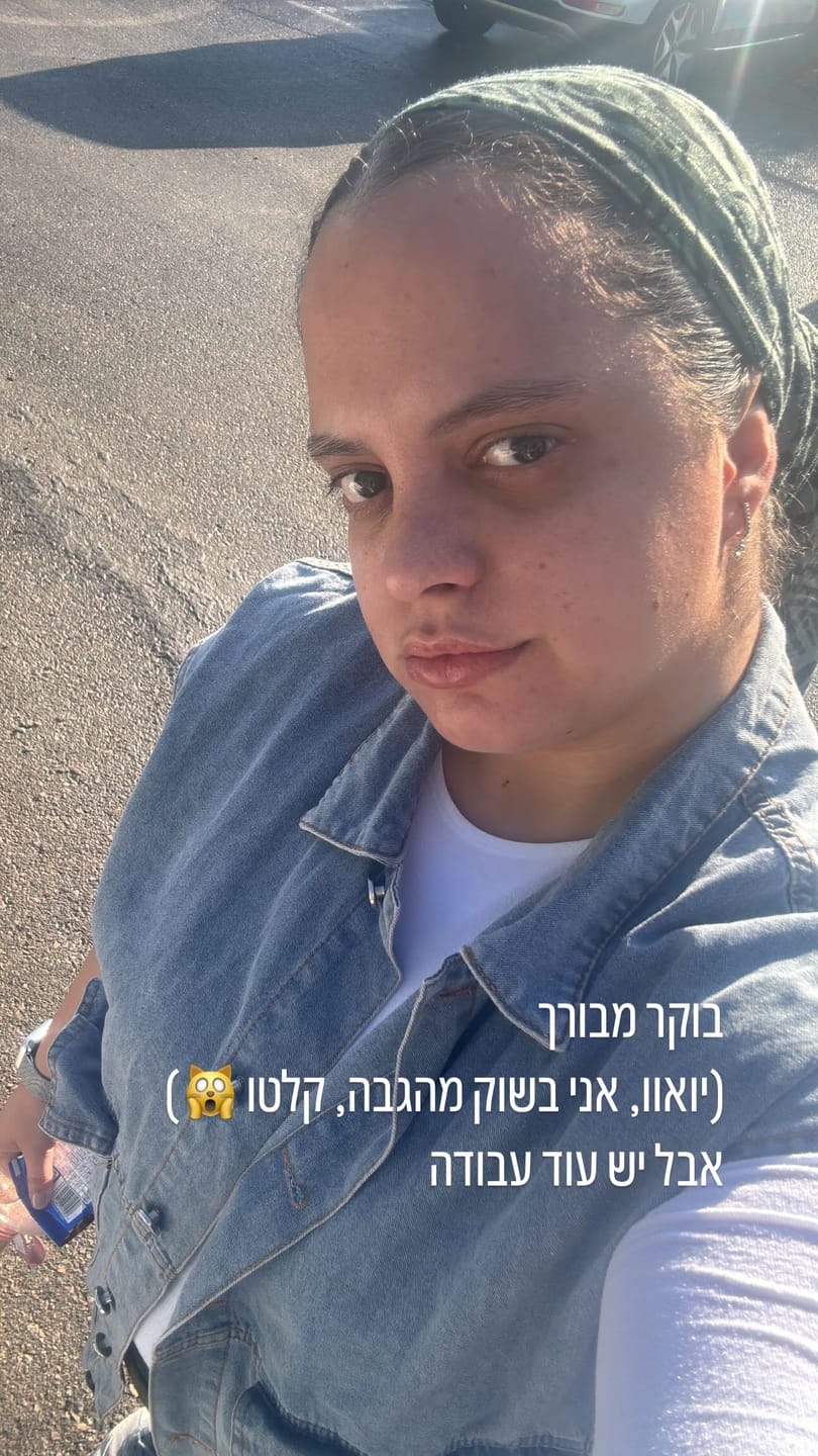 Customer photo review of IZABELL ROLLER - רולר לצמיחת הגבות מחדש