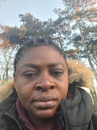 Customer photo review of Anti-Acne & Dark Spots African Soap