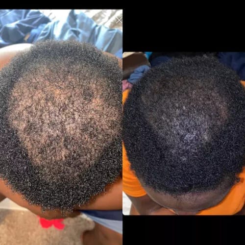 Customer photo review of Movatte Ultra Drops