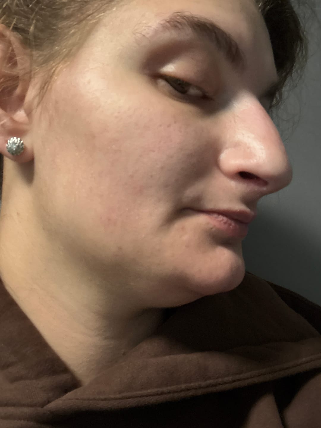 Customer photo review of Everywhere Tallow Balm