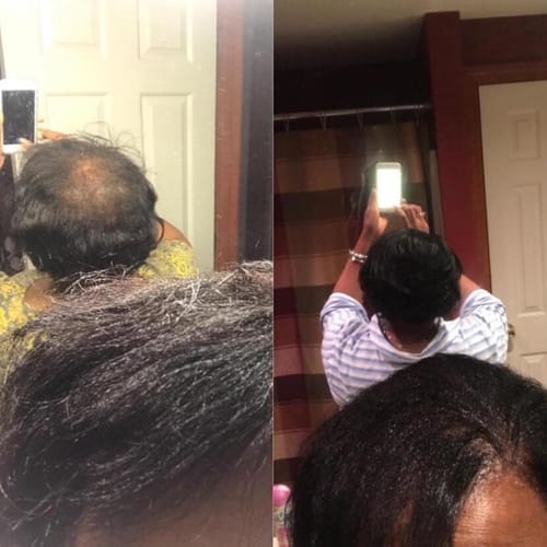 Customer photo review of Movatte 3-Phase Growth System™