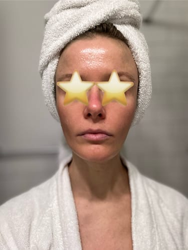 Customer photo review of BeautyPro 2.0 - High Frequency Wand