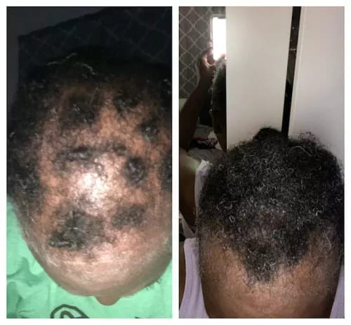 Customer photo review of Movatte Ultra Drops