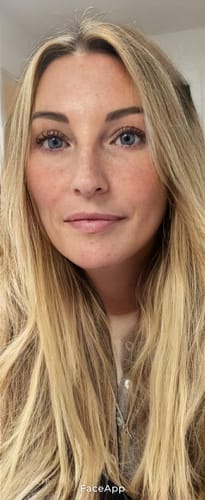 Customer photo review of Rosalique 3 in 1 Anti-Redness Miracle Formula SPF50