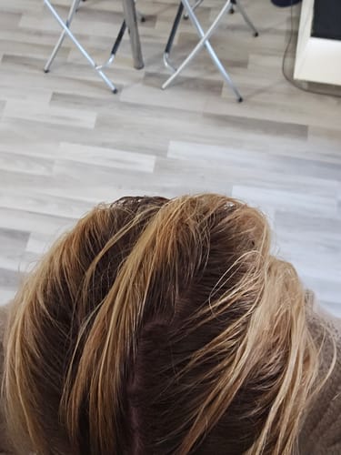 Customer photo review of Sunkissed Refill 3-pack