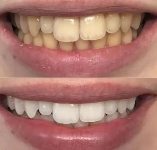 Customer photo review of Farbkorrektur - Serum - Black Deal