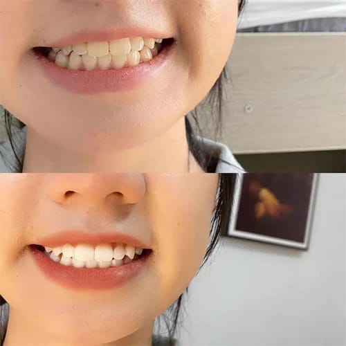 Customer photo review of Farbkorrektur - Serum - Black Deal