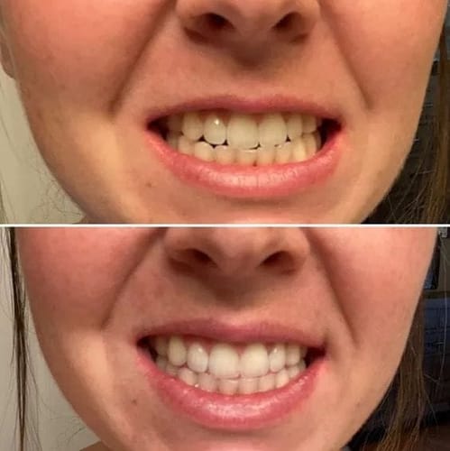 Customer photo review of Farbkorrektur - Serum - Black Deal