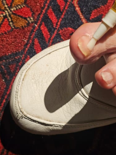Customer photo review of Onychom - Lézeres eszköz kéz- és lábköröm kezelésére