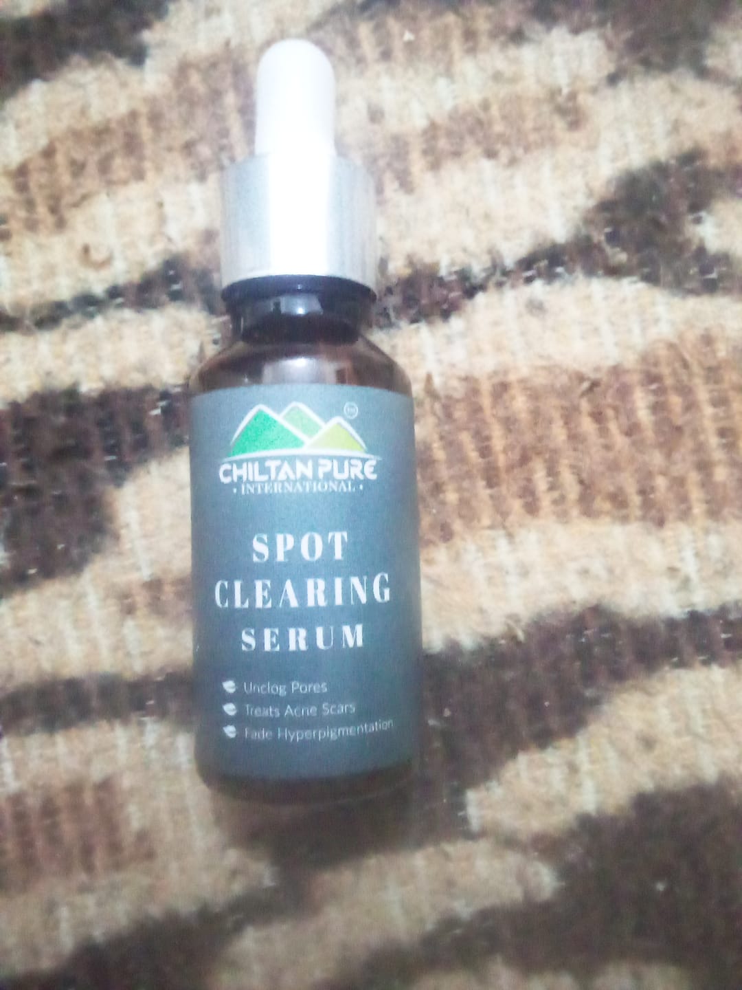 Customer photo review of Spot Clearing Serum – Unclog Pores, Reduce Dark Spots & Fade Hyperpigmentation