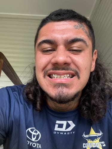 Customer photo review of ZOLARA (SILVER GRILLZ)