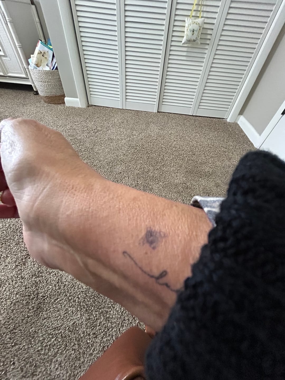 Customer photo review of Bee Tattoo - Semi Permanent