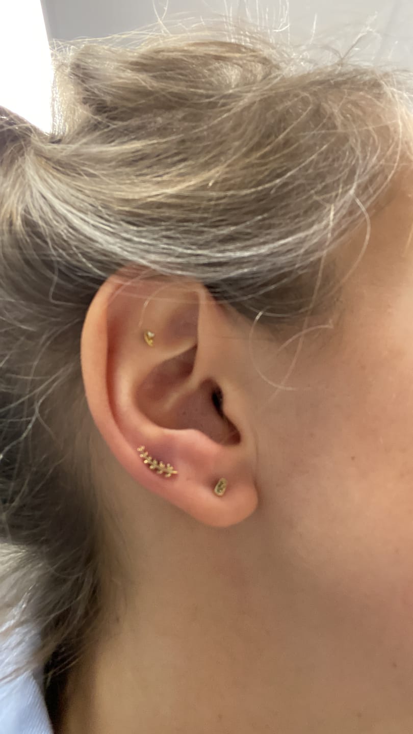 Customer photo review of Junipurr Titanium Flatback Labret Threadless