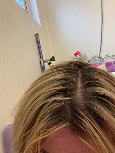 Customer photo review of Sunkissed Refill 3-pack