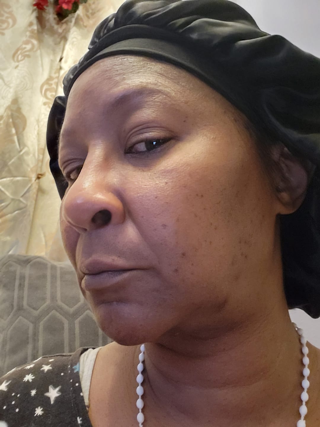 Customer photo review of Dark Spot Corrector Serum