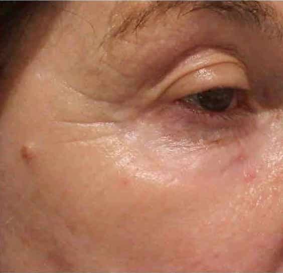 Customer photo review of Under Eye Skincare Wand