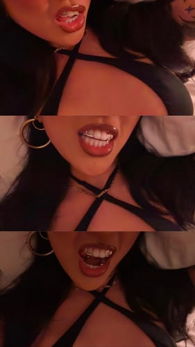 Customer photo review of PRISM (GOLD GRILLZ)