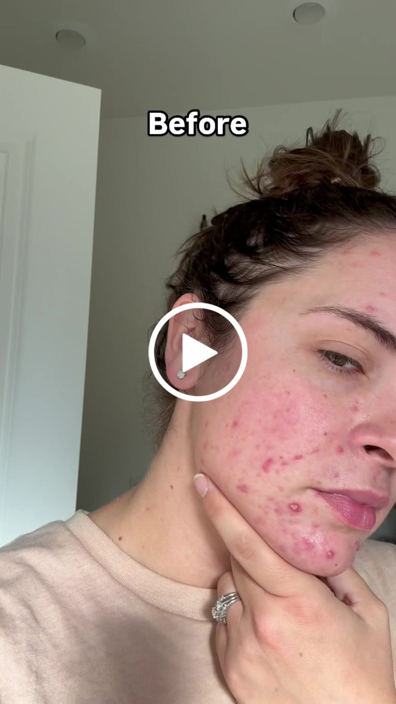 Customer video review of Women's Gut Rebalance Kit