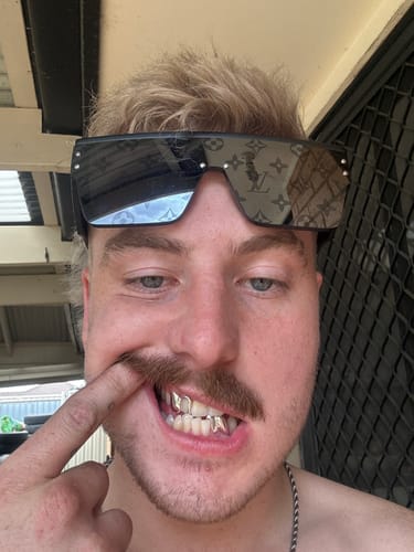 Customer photo review of PRISM (SILVER GRILLZ)