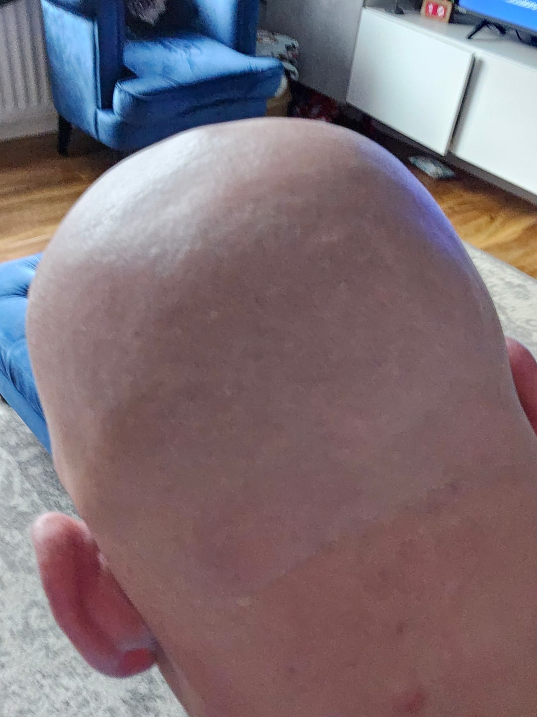 Customer photo review of Trim Pod 2.0
